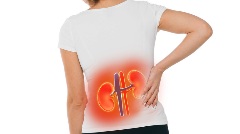 Back of woman with kidneys superimposed over her shirt and highlighted red to indicate pain