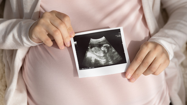 Pregnant woman holding ultrasound photo