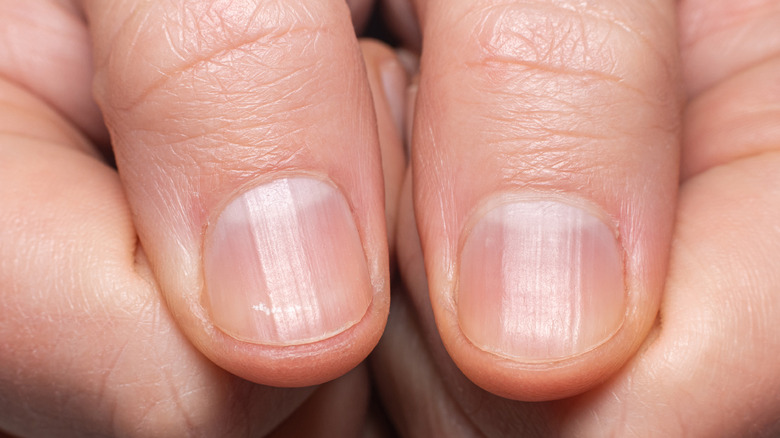 person's fingernails