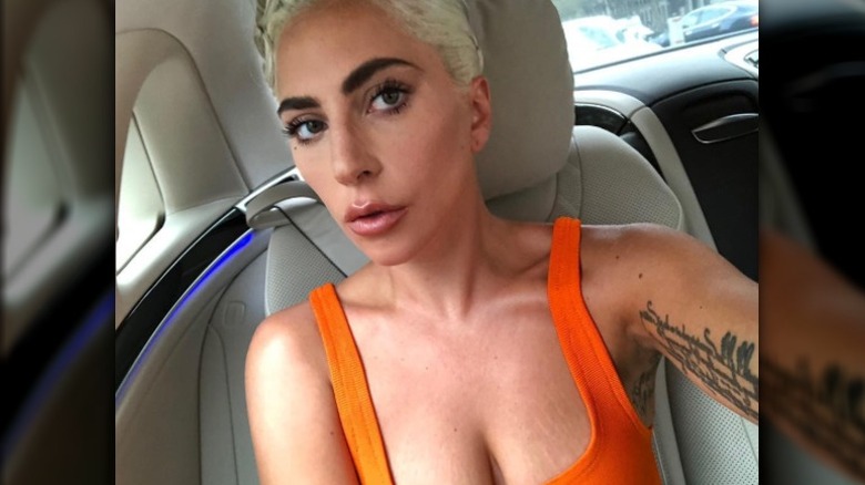 Lady Gagy image showing stretch marks on her chest