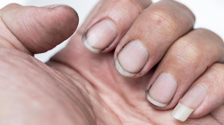 A closeup of dirty fingernails