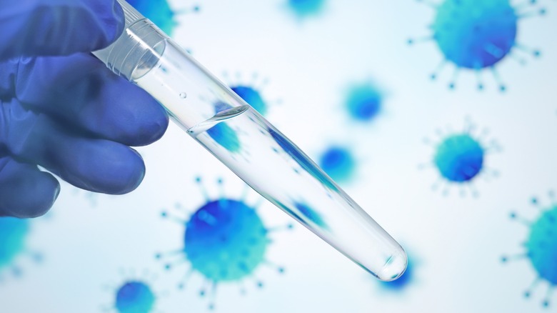 bacterial culture test