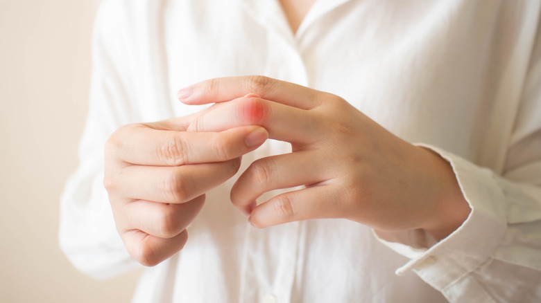 hand showing joint pain 