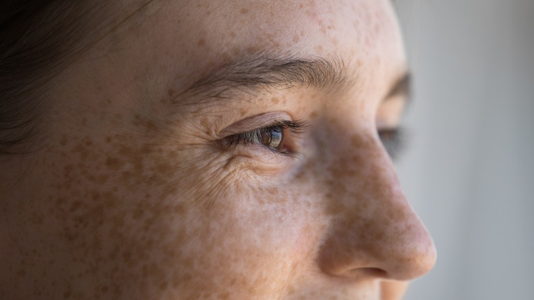 Closeup of woman's freckled face