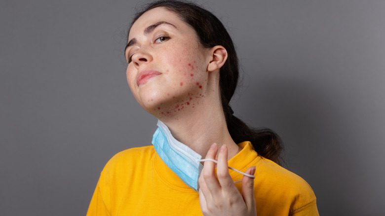 girl with acne on neck