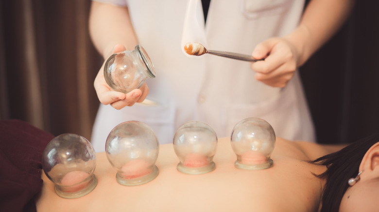 woman during cupping session