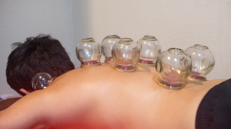 person during cupping session