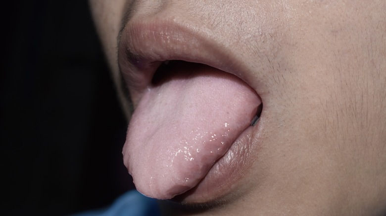 Close up on person sticking our their pale tongue