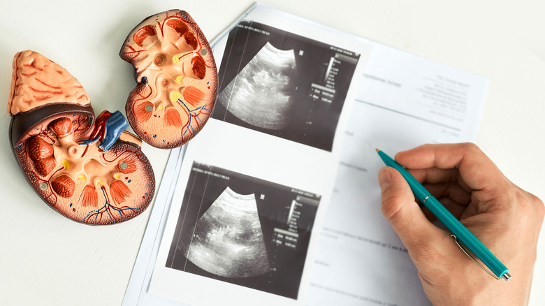 Kidney model and ultrasound pictures