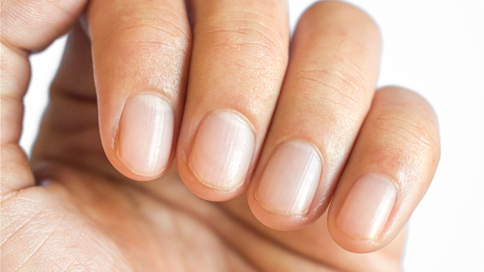 Top view of male hand with brown line on one of the finger's nail better  known as melanonychia (nail pigmentation) on black and matte background  surfa Stock Photo - Alamy