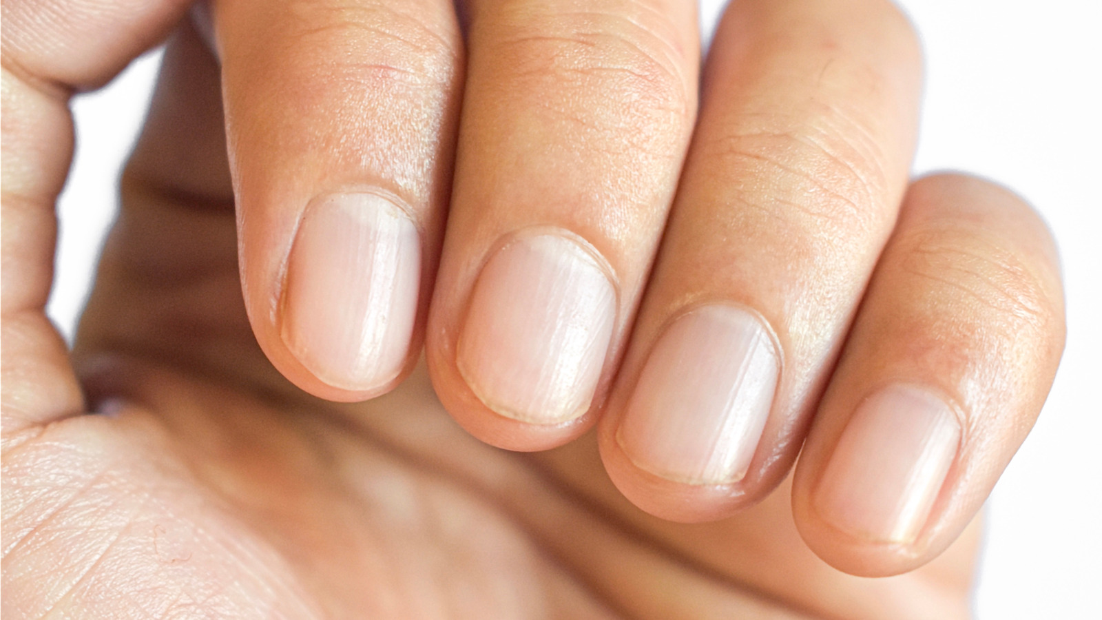 Nail Pitting: 7 Causes and Treatments, image size:1600x900
