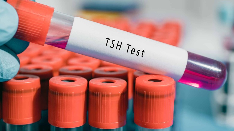 blood sample for tsh test