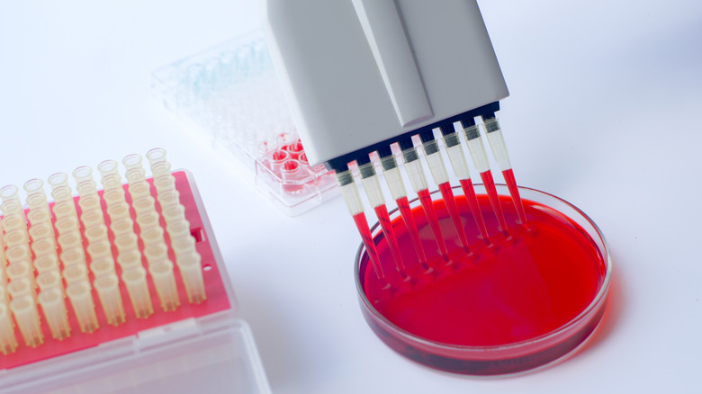 white blood cell test in lab