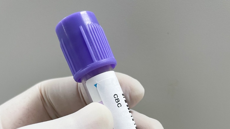 Blood sample for WBC test