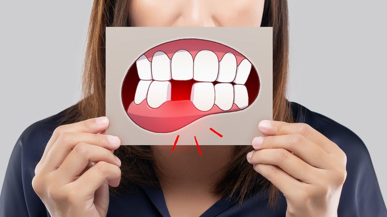 asian woman shows decay tooth on paper