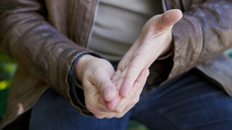 hands showing a Raynaud's flare