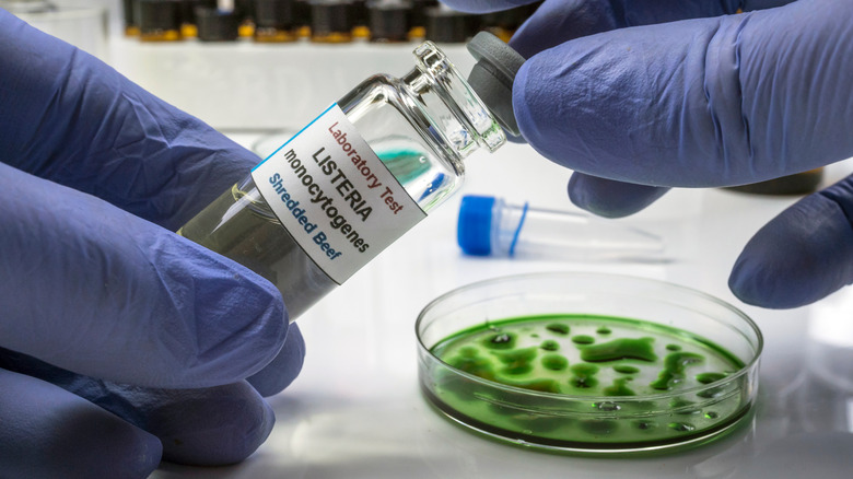 Someone testing listeria in a lab