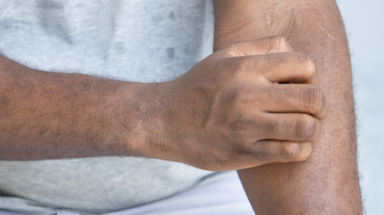 man scratching arm with ringworm