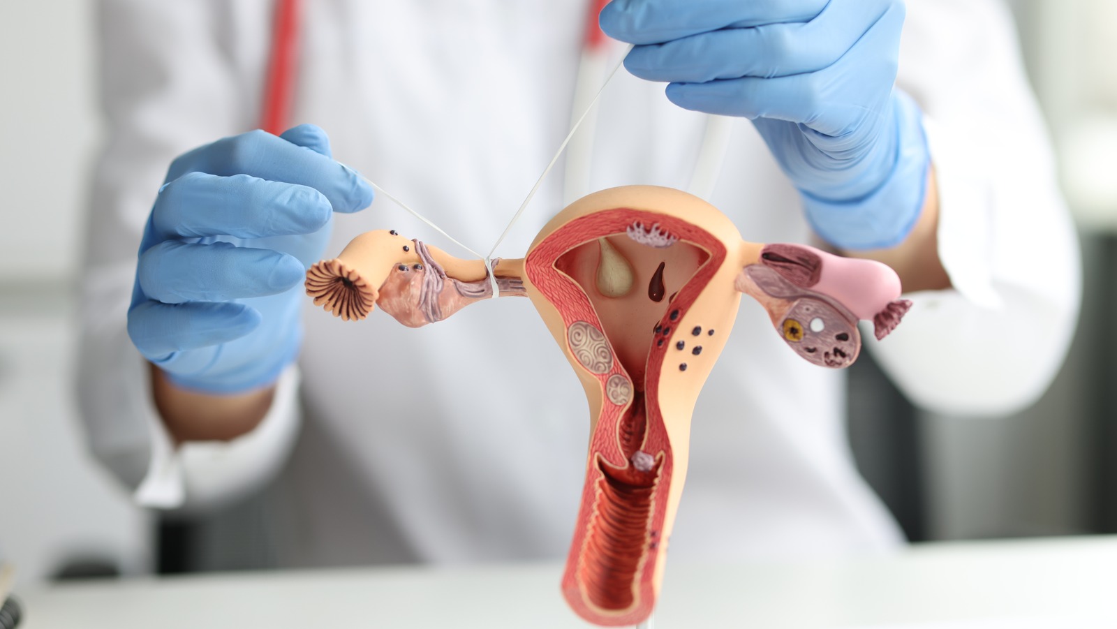 What Happens If You Get Pregnant After Getting Your Tubes Tied