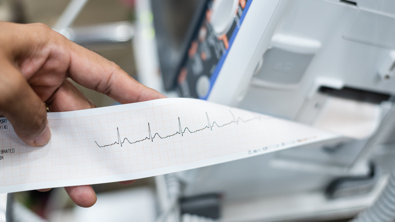 man holding a printout of EKG test results