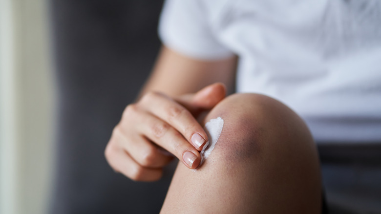 Woman rubbing cream on leg