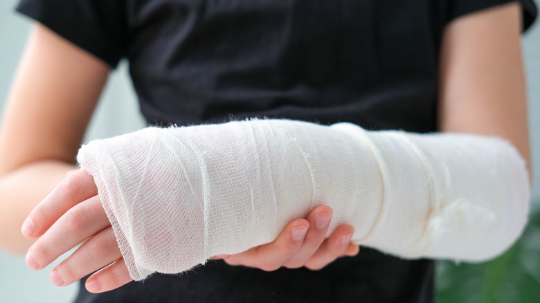 person with broken arm in cast