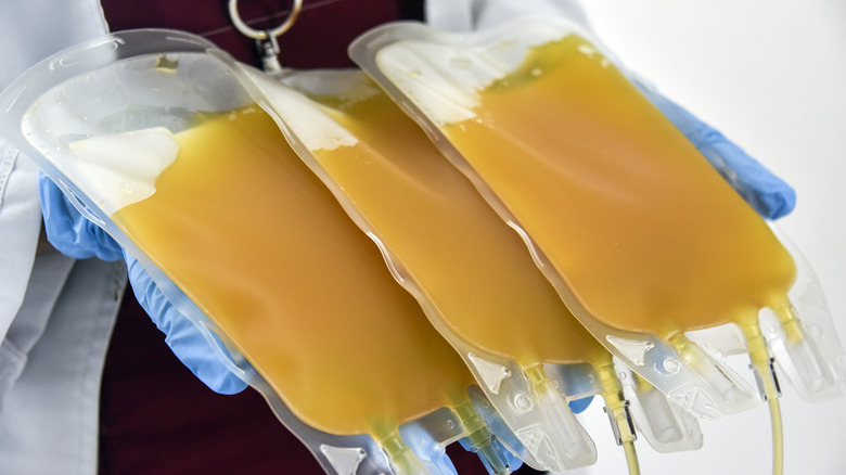 Person holding three bags of blood plasma
