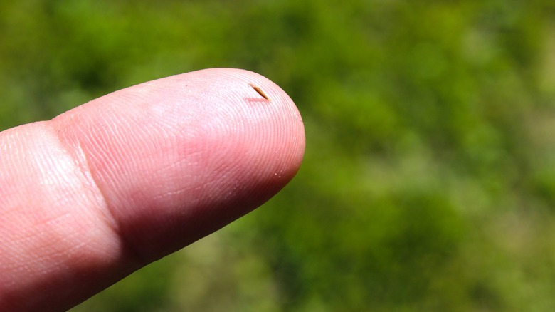 Splinter in finger