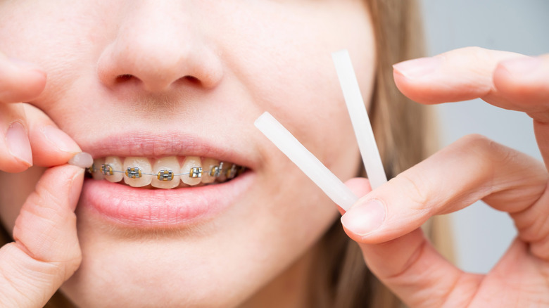 person holding orthodontic wax