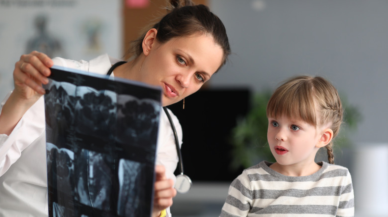 doctor showing bone scan to child