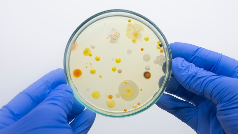 Petri dish with bacteria