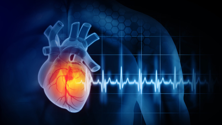 Digital heart rhythm model