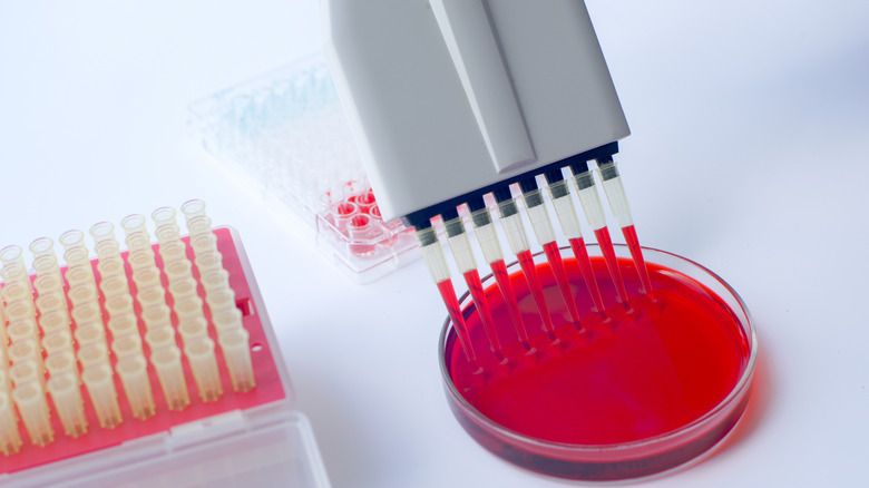 Blood testing hemophilia 