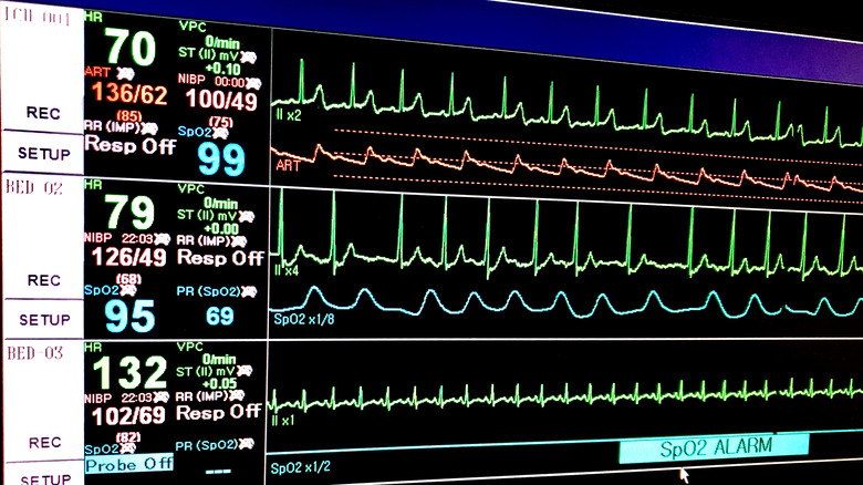 Electrocardiogram can be used for diagnosis of myocarditis