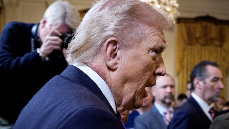 What Is The Rash On Donald Trump's Neck? The Offered Explanation From His Doctor Ignites Speculation