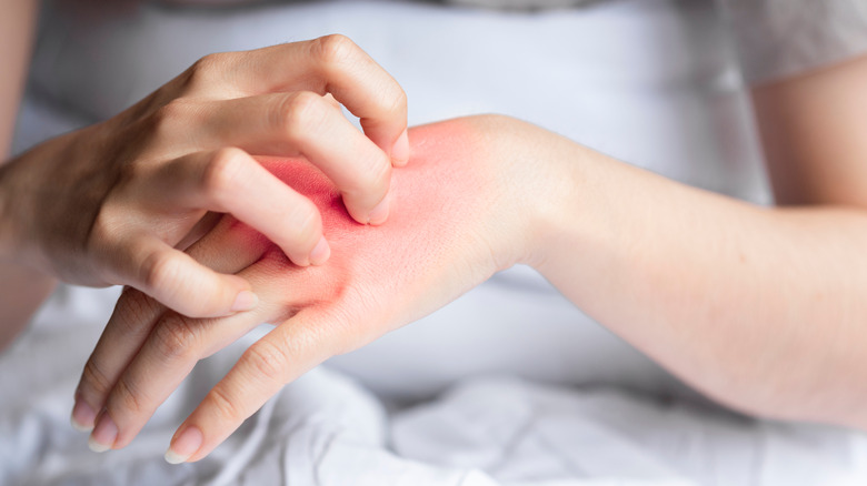 woman scratching her itchy skin