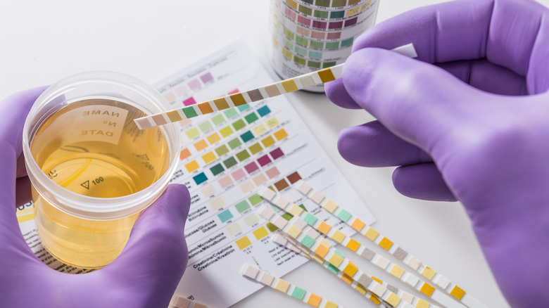 Testing urine sample at lab
