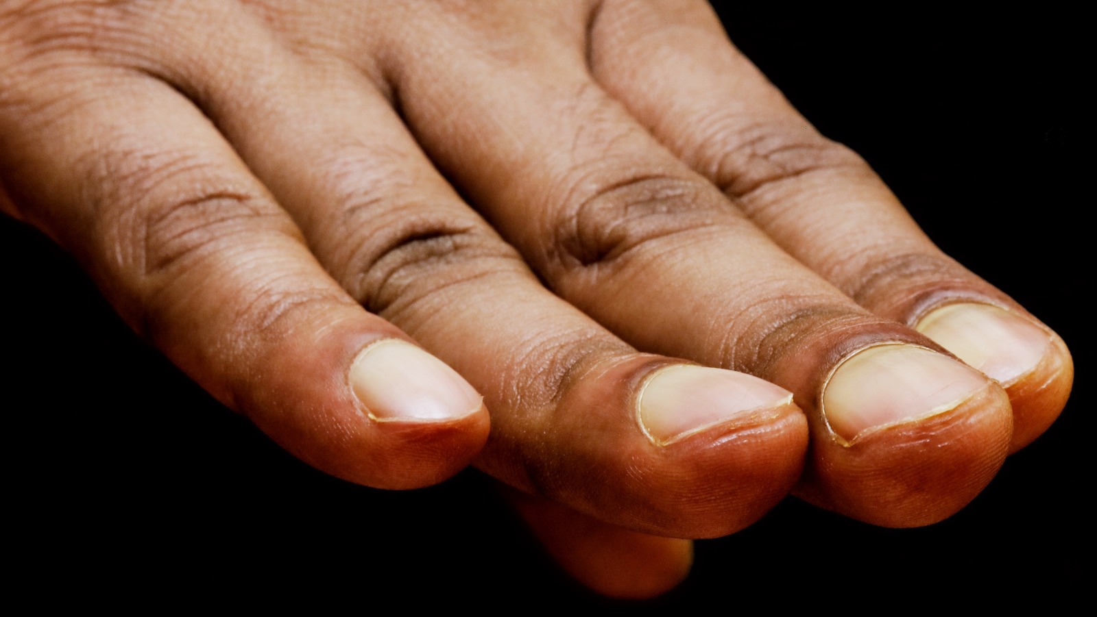 White marks on nails: Here's what they actually mean.