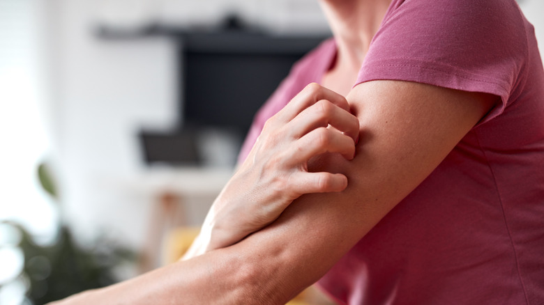 Hand scratching arm
