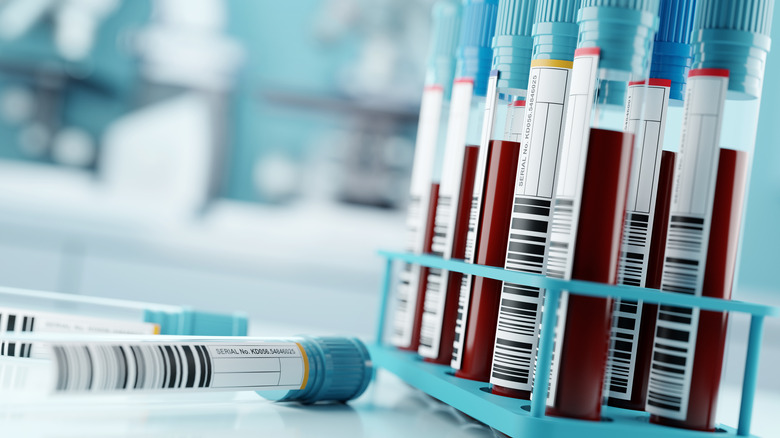 Blood samples in a medical lab