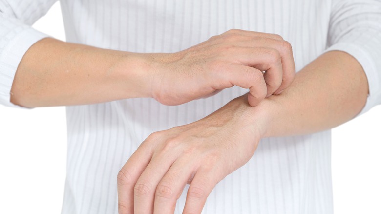 man scratching wrist