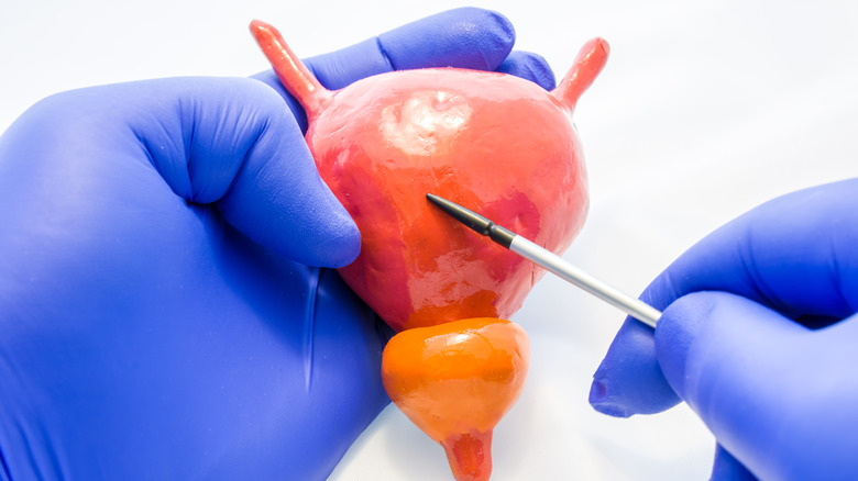 Doctor holding an anatomical model of the human bladder