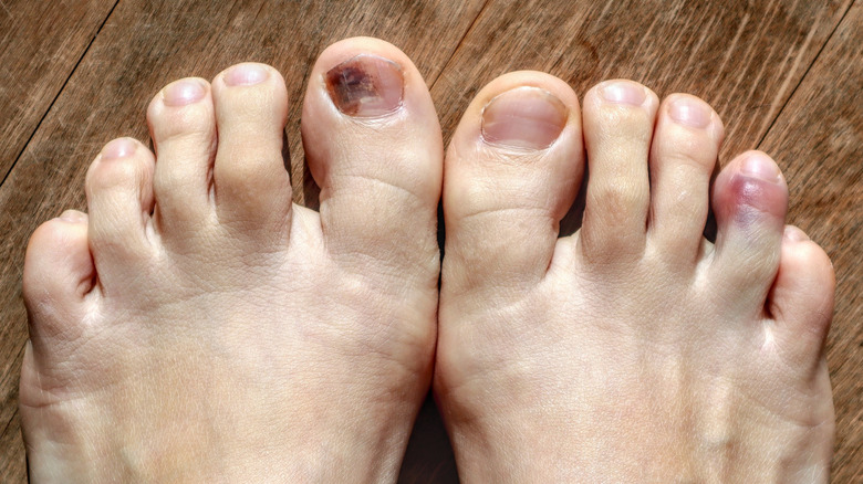 feet with purple toenails