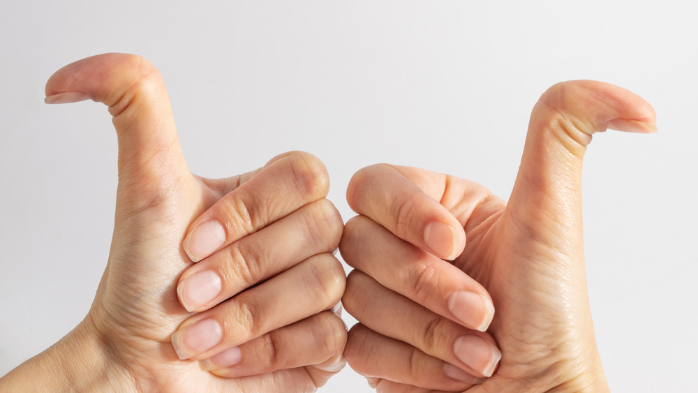 A woman's hypermobile hand