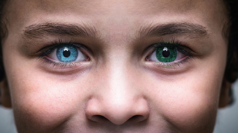 Child with one green eye and one blue eye 