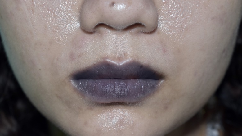 Close up of face and lips with cyanosis
