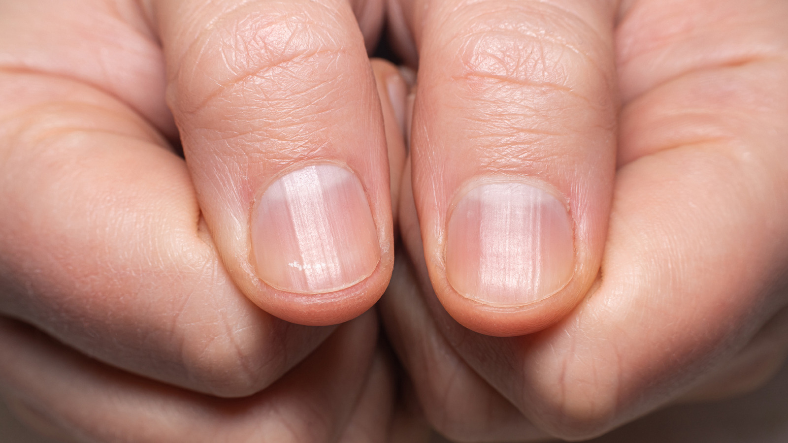 What It Really Means When Your Fingernails Won't Grow