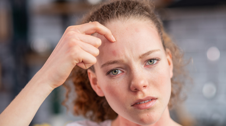 Woman scratching her forehead