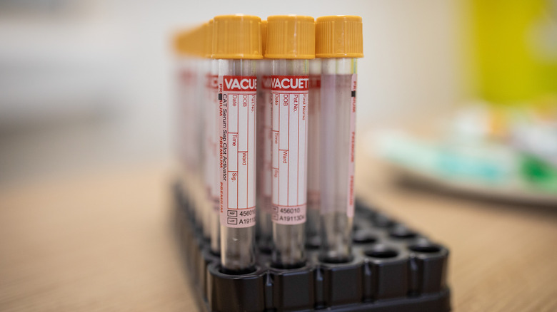 blood test vials