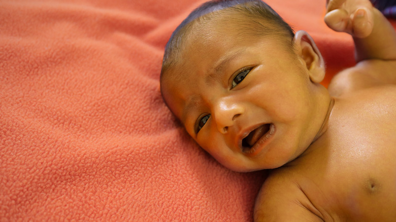 baby with yellowing skin crying